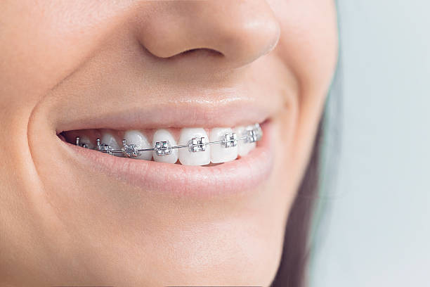Best Full Mouth Reconstruction  in Louisiana, MO